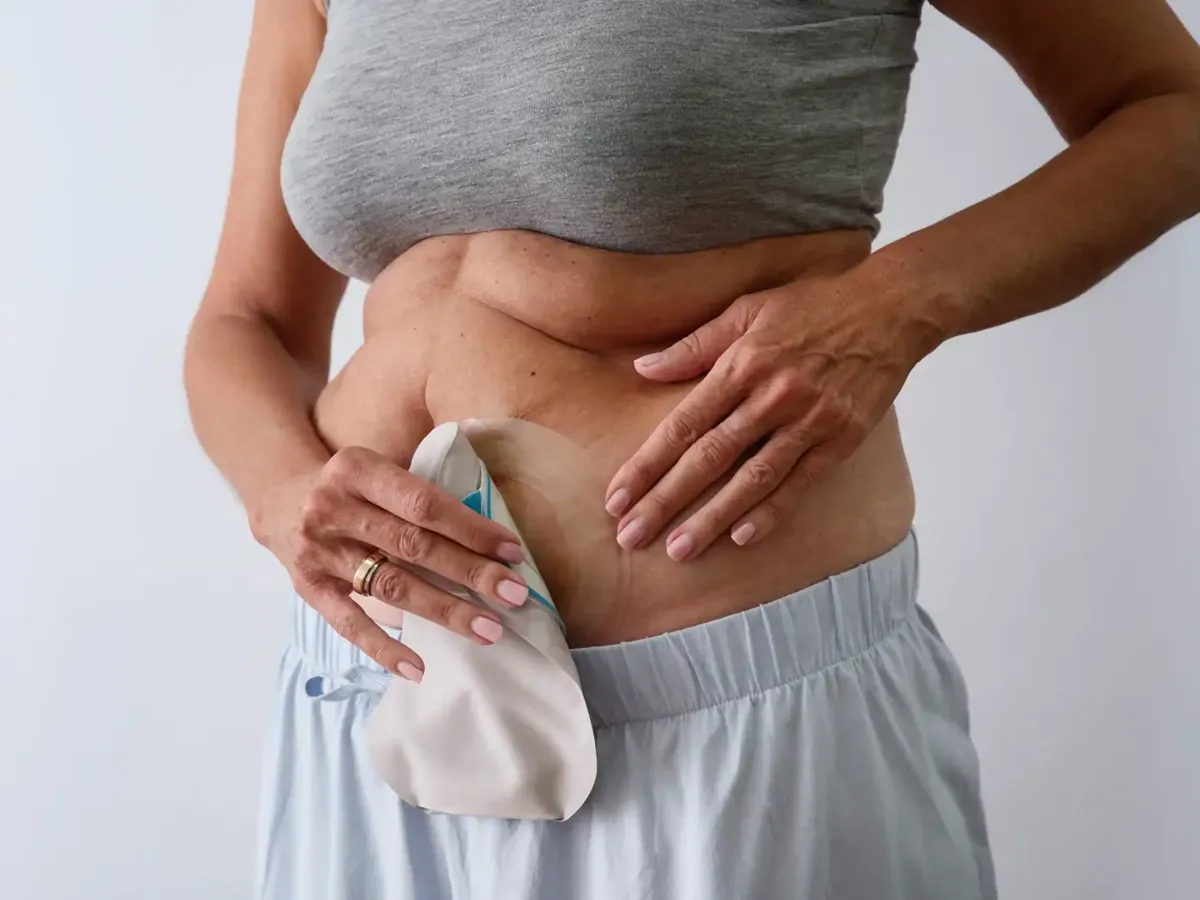 Ostomy Care