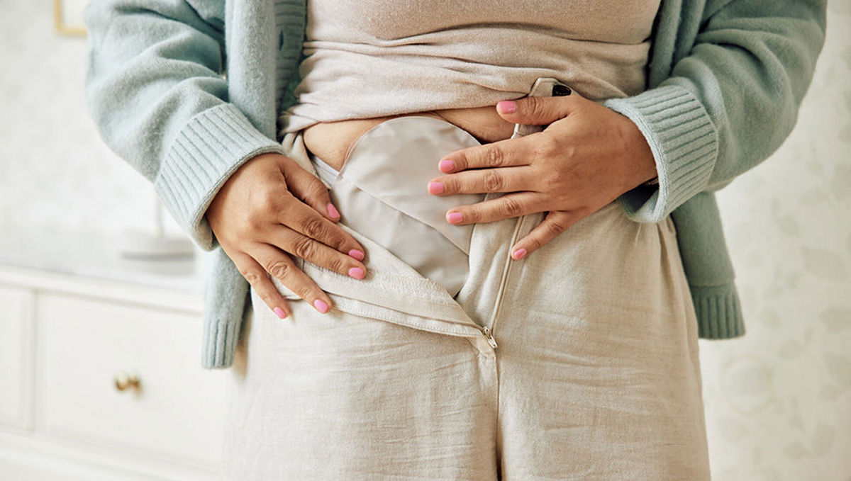 SenSura® Mio ostomy bags and plates